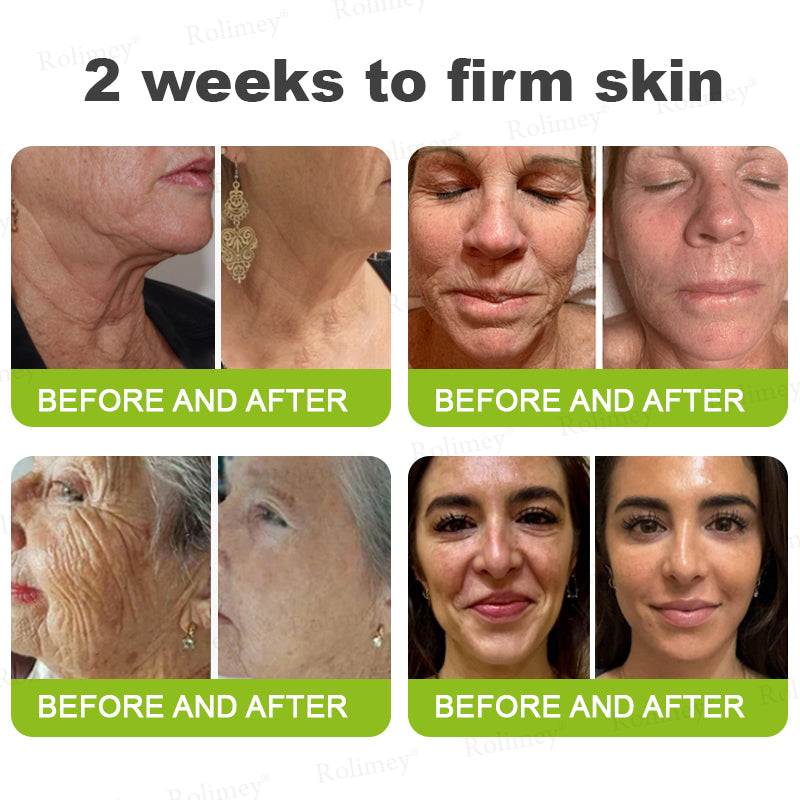 👩‍⚕️Made and shipped from the USA 💫Rolimey® Botox & Vita-A Retinol Shot Wrinkle-Lift Tightening cream - Last Day Promotion 70% OFF