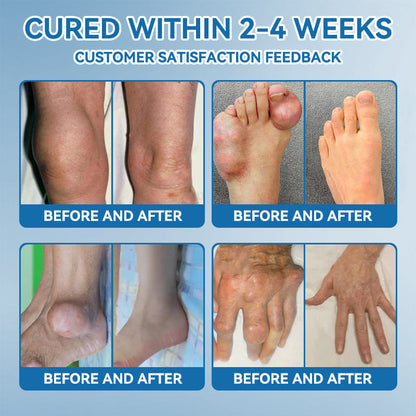💧Flysmus™ BPC-157 Joint Healing Cream🦴Treats Arthritis, Neuropathy, Rheumatism, Sports Injuries & More👍
