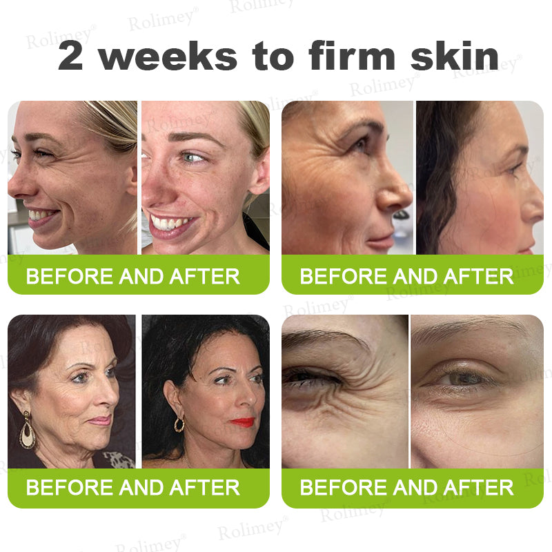 👩‍⚕️Made and shipped from the USA 💫Rolimey® Botox & Vita-A Retinol Shot Wrinkle-Lift Tightening cream - Last Day Promotion 70% OFF