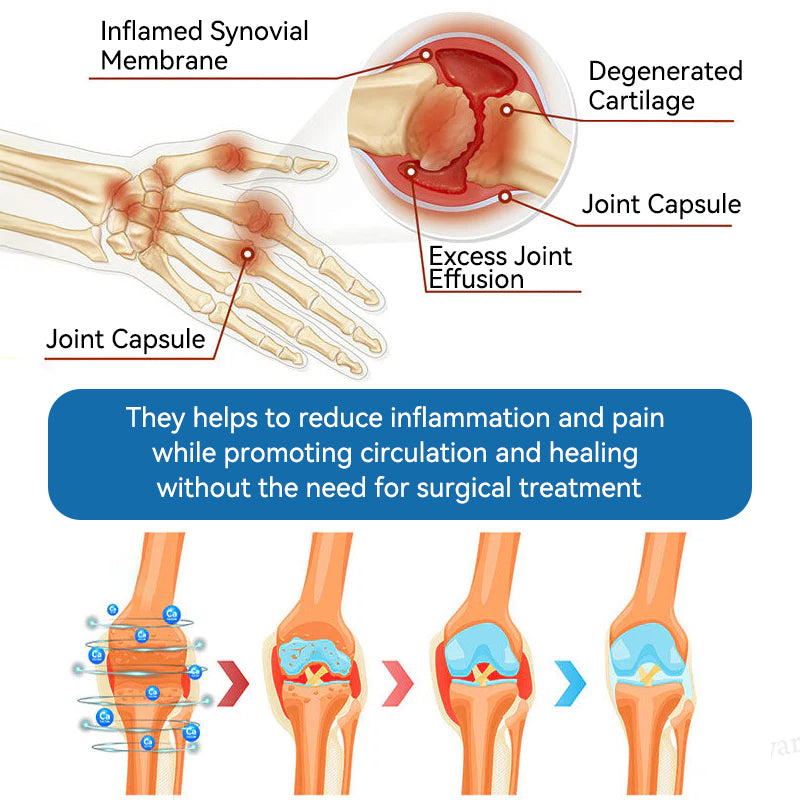 💧Flysmus™ BPC-157 Joint Healing Cream🦴Treats Arthritis, Neuropathy, Rheumatism, Sports Injuries & More👍