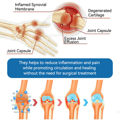 💧Flysmus™ BPC-157 Joint Healing Cream🦴Treats Arthritis, Neuropathy, Rheumatism, Sports Injuries & More👍