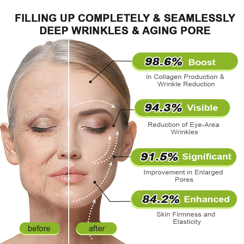 👩‍⚕️Made and shipped from the USA 💫Rolimey® Botox & Vita-A Retinol Shot Wrinkle-Lift Tightening cream - Last Day Promotion 70% OFF