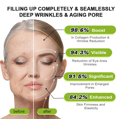 👩‍⚕️Made and shipped from the USA 💫Rolimey® Botox & Vita-A Retinol Shot Wrinkle-Lift Tightening cream - Last Day Promotion 70% OFF