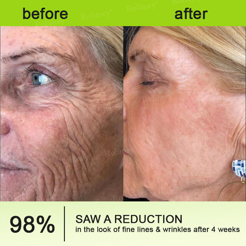 👩‍⚕️Made and shipped from the USA 💫Rolimey® Botox & Vita-A Retinol Shot Wrinkle-Lift Tightening cream - Last Day Promotion 70% OFF