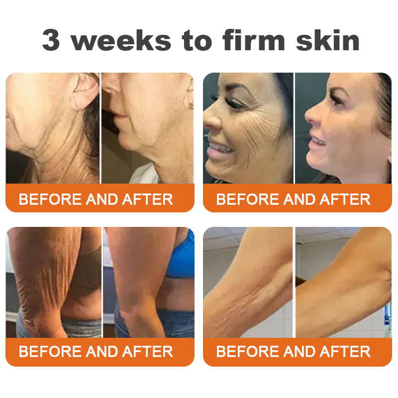 💚Flysmus™ Botox Bee Venom Firming Serum Stick LAST DAY 70% OFF