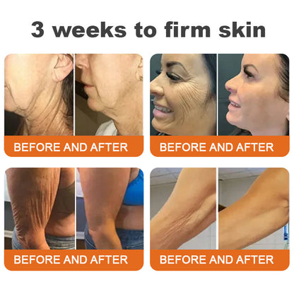💚Flysmus™ Botox Bee Venom Firming Serum Stick LAST DAY 70% OFF