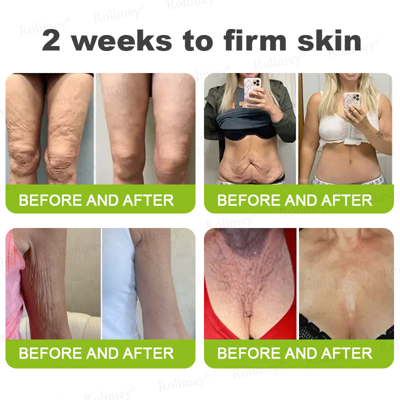 👩‍⚕️Made and shipped from the USA 💫Rolimey® Botox & Vita-A Retinol Shot Wrinkle-Lift Tightening cream - Last Day Promotion 70% OFF