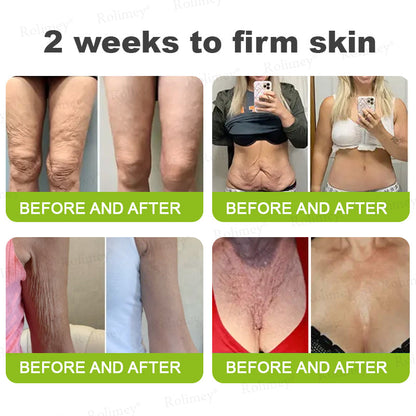 🌹Made and shipped from the CA 💫Rolimey® Botox & Vita-A Retinol Shot Wrinkle-Lift Tightening cream - Last Day Promotion 70% OFF