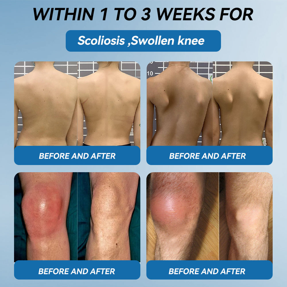💧Flysmus™ BPC-157 Joint Healing Cream🦴Treats Arthritis, Neuropathy, Rheumatism, Sports Injuries & More👍