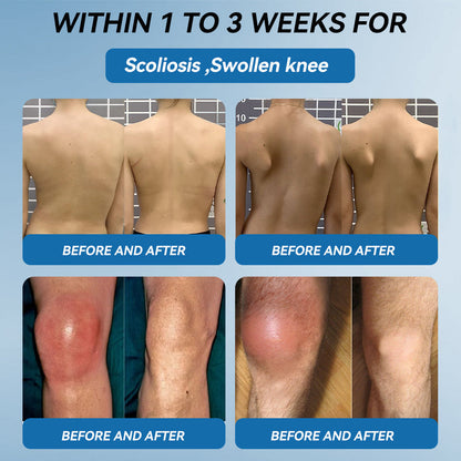 💧Flysmus™ BPC-157 Joint Healing Cream🦴Treats Arthritis, Neuropathy, Rheumatism, Sports Injuries & More👍