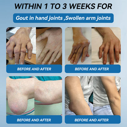 💧Flysmus™ BPC-157 Joint Healing Cream🦴Treats Arthritis, Neuropathy, Rheumatism, Sports Injuries & More👍