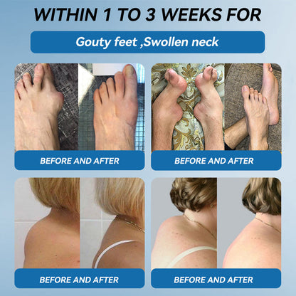 💧Flysmus™ BPC-157 Joint Healing Cream🦴Treats Arthritis, Neuropathy, Rheumatism, Sports Injuries & More👍