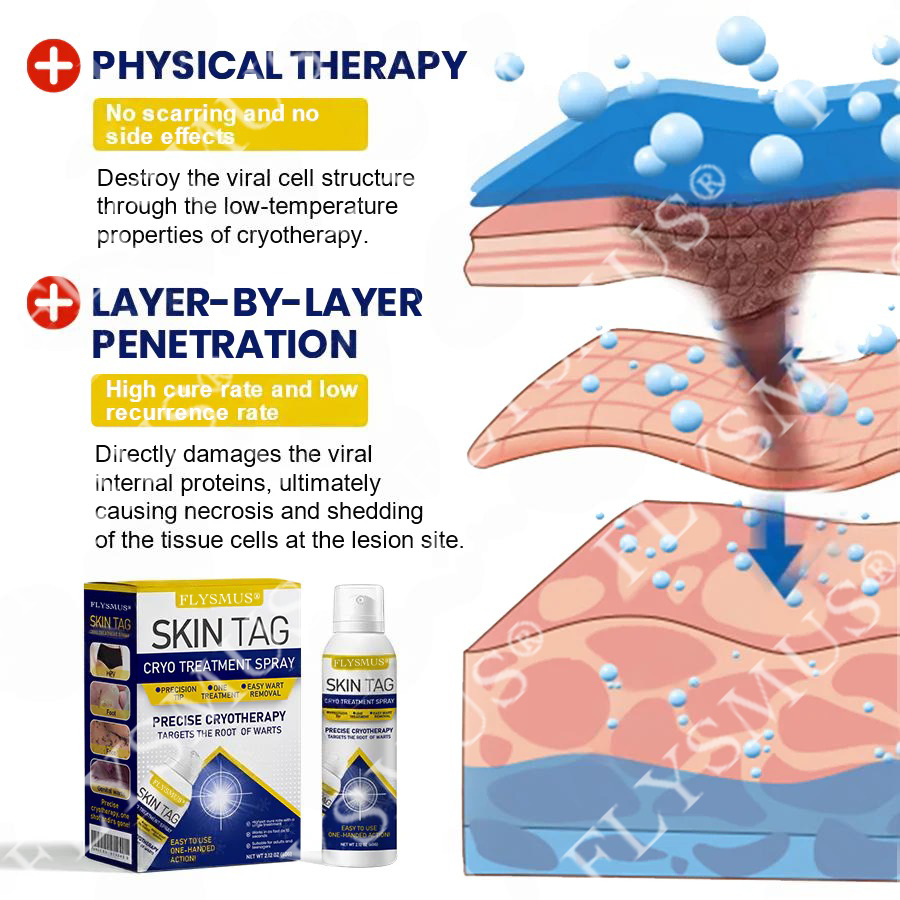 FLYSMUS® SKIN TAG CRYO TREATMENT SPRAY ACE
